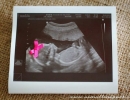 Sweet ultrasound baby photo with bow | 10 Creative Gender Reveal Ideas - Tinyme Blog